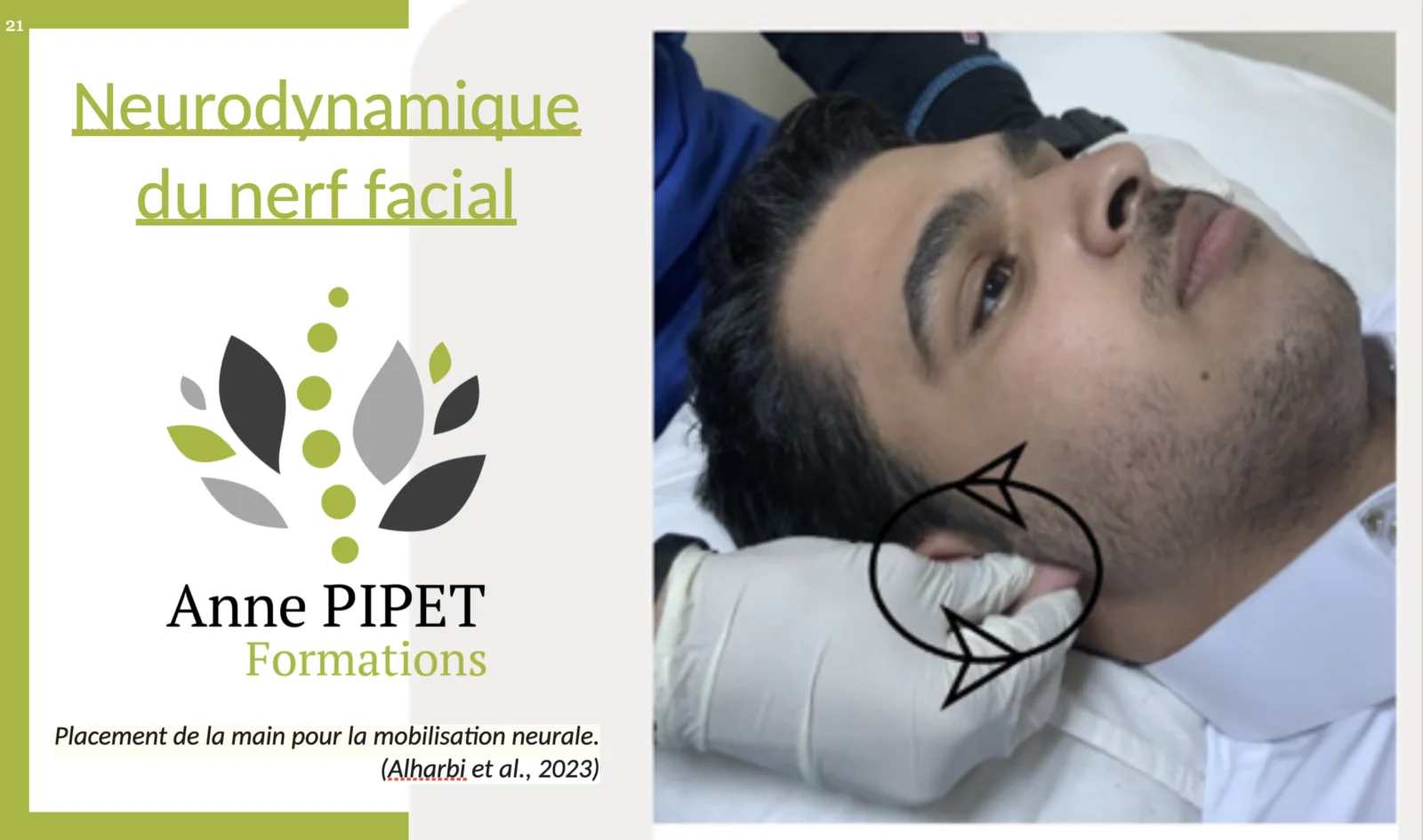 Les techniques de neurodynamique appliquées au nerf facial : mon analyse critique