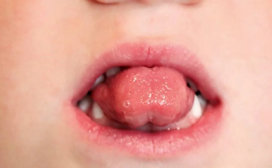 Formation kiné maxillo-faciale sur la la prise en charge des fonctions maxillo-faciales dans le cadre des traitements orthodontiques destinée aux kinésithérapeutes et orthophonistes