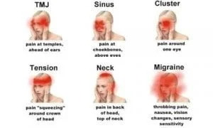 Formation algies de la face