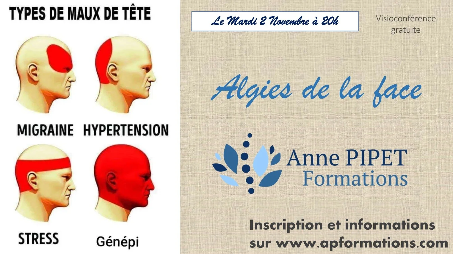 Visioconférence sur les algies de la face