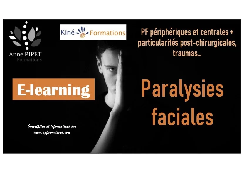 Elearning Paralysies Faciales