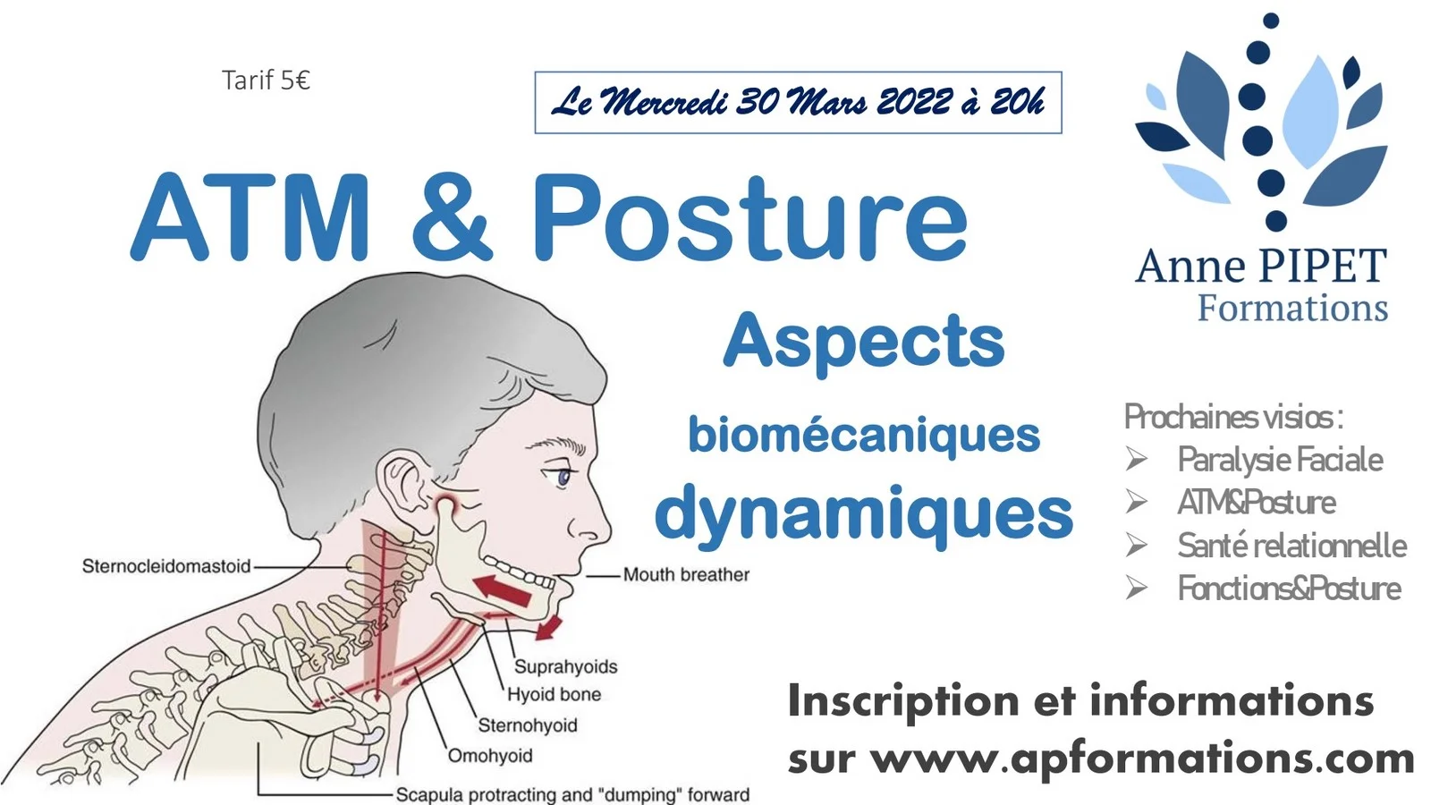 Visioconférence sur ATM et Posture